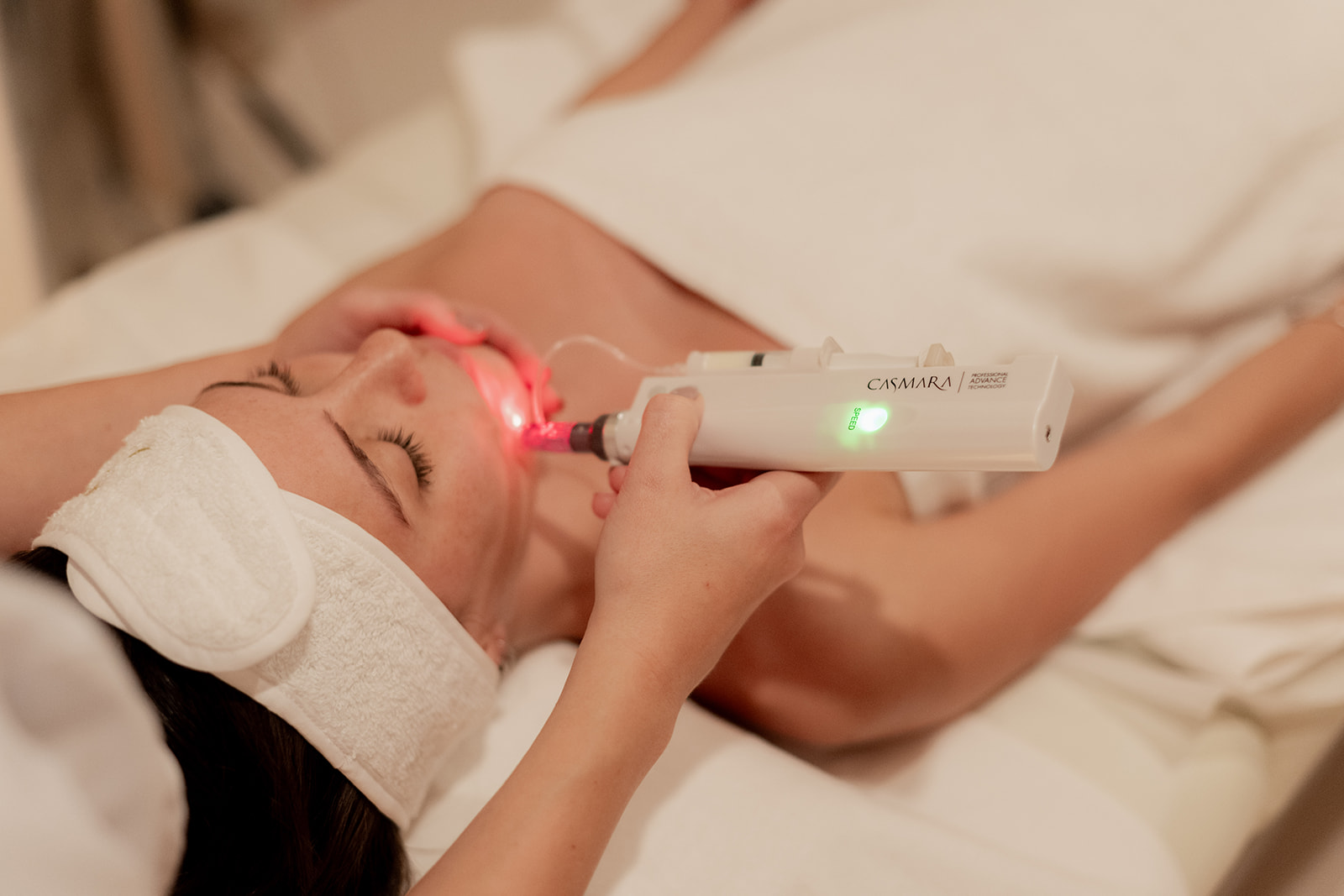 Tratamiento facial Valencia_Dermapen Valencia