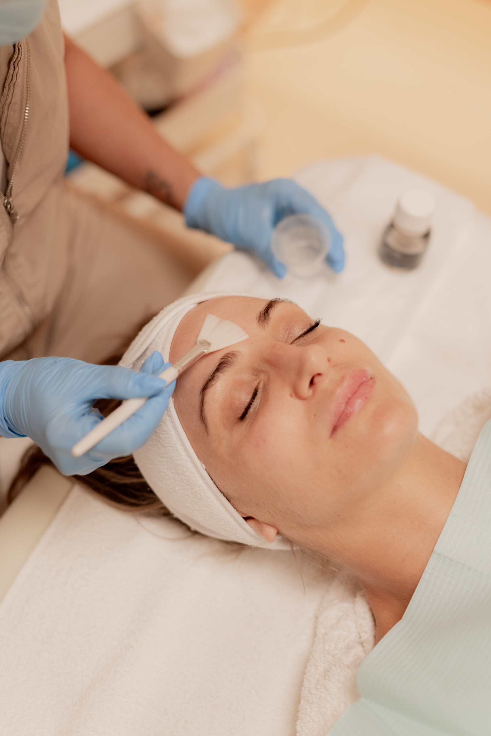 Tratamiento facial Valencia_peeling químico valencia