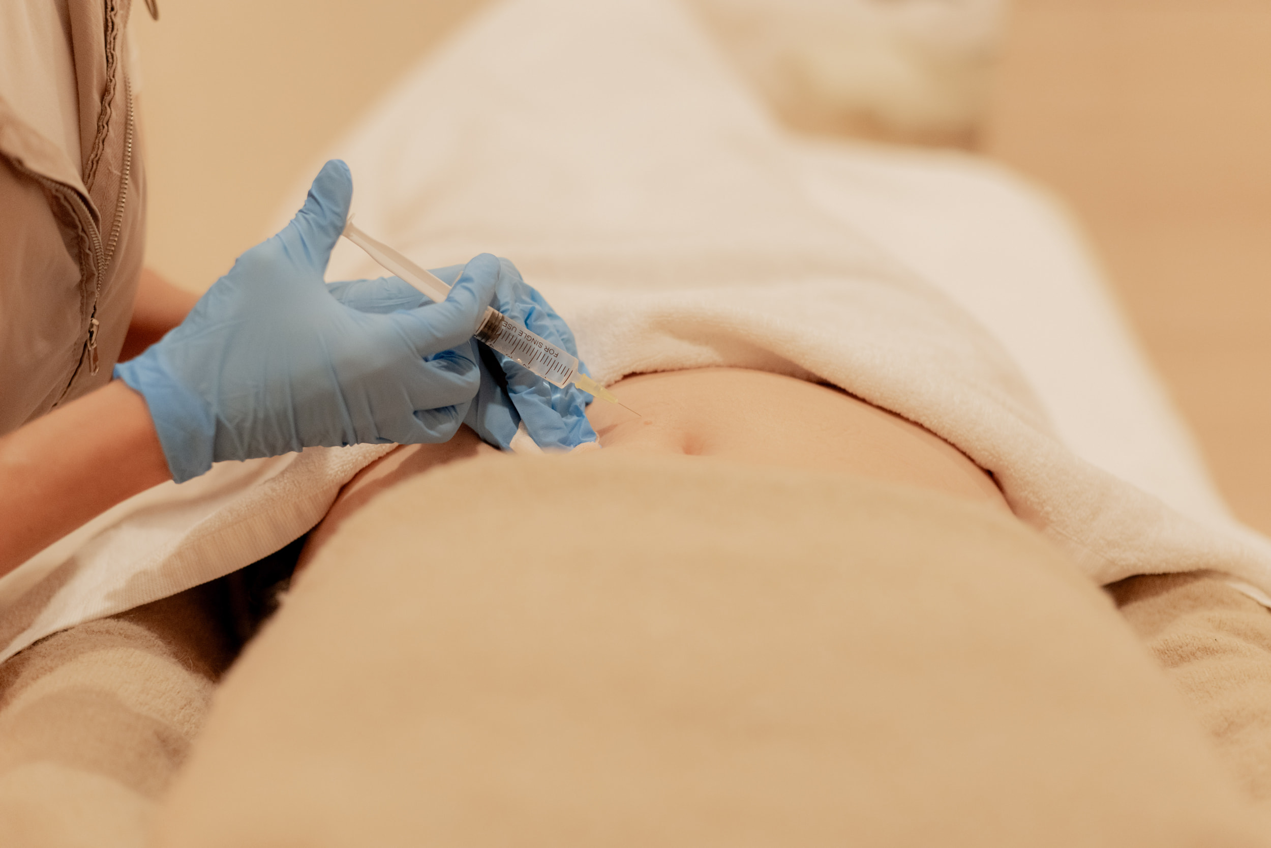 mesoterapia valencia
