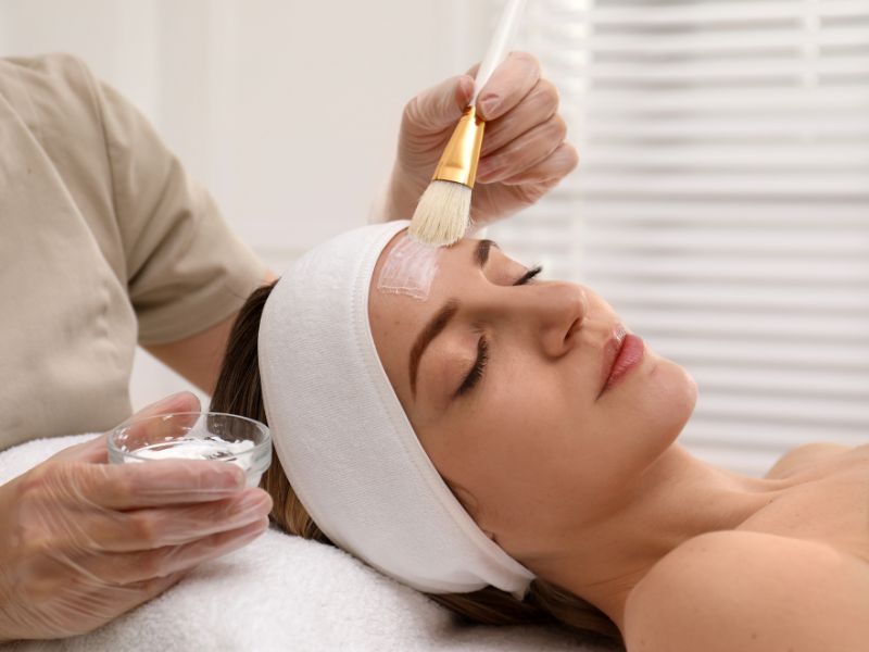 tratamiento de peeling químico
